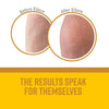 O'Keeffe's Skin Repair Tube 198 gm